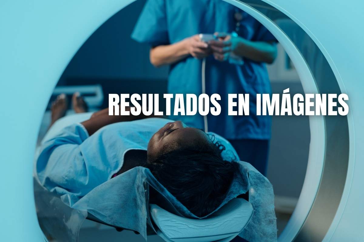 resultados imagenes